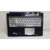 Acer Aspire E1-572P-6403 üst kasa Acer Aspire E1-572P-6403 üst kasa